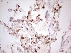 ABCB1 Monoclonal Antibody (OTI8A9), TrueMAB , OriGene 100 &mu;L; Unconjugated:Antibodies,