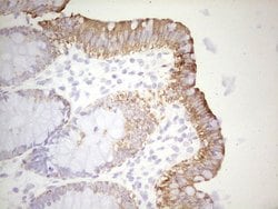 ABCB1 Monoclonal Antibody (OTI11D2), TrueMAB , OriGene 100 &mu;L; Unconjugated:Antibodies,