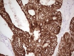 ABCB1 Monoclonal Antibody (OTI11D2), TrueMAB , OriGene 100 &mu;L; Unconjugated:Antibodies,