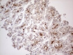 ABCB1 Monoclonal Antibody (OTI6E4), TrueMAB , OriGene 100 &mu;L; Unconjugated:Antibodies,