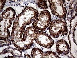 ABCB1 Mouse anti-Human, Clone: OTI16D9, TrueMAB , Origene 30 &mu;L; Unconjugated:Antibodies,