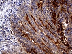 ABCB1 Mouse anti-Human, Clone: OTI2H2, lyophilized, TrueMAB 100 &mu;g;