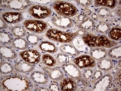 ABCB1 Mouse anti-Human, Clone: OTI2H2, lyophilized, TrueMAB 100 &mu;g;