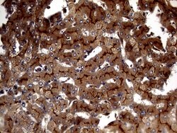 ABCB1 Mouse anti-Human, Clone: OTI2H2, lyophilized, TrueMAB 100 &mu;g;