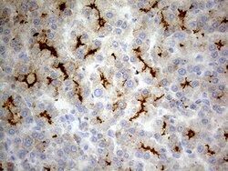 ABCB1 Mouse anti-Human, Clone: OTI2H2, lyophilized, TrueMAB 100 &mu;g;