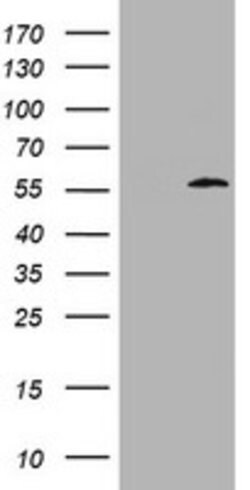 ABCB1 Mouse anti-Human, Clone: OTI3H7, lyophilized, TrueMAB 100 &mu;g;