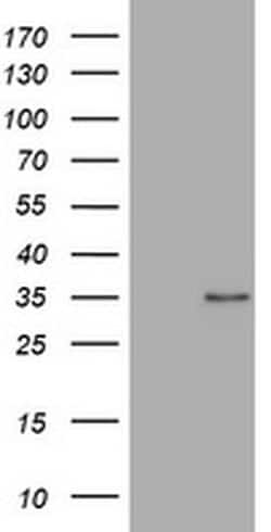 ABCB1 Monoclonal Antibody (OTI5F1), TrueMAB , OriGene 100 &mu;L; Unconjugated:Antibodies,