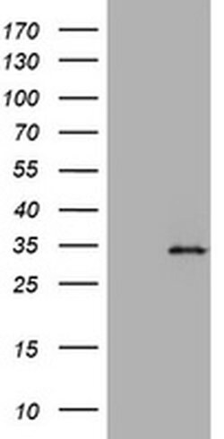 ABCB1 Monoclonal Antibody (OTI5F1), TrueMAB , OriGene 100 &mu;L; Unconjugated:Antibodies,