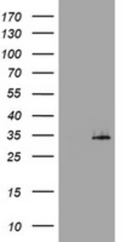 ABCB1 Mouse anti-Human, Clone: OTI1A3, lyophilized, TrueMAB 100 &mu;g;