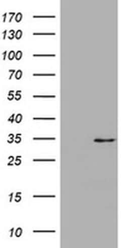 ABCB1 Monoclonal Antibody (OTI5D1), TrueMAB , OriGene 100 &mu;L; Unconjugated:Antibodies,