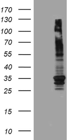 ABCB1 Mouse anti-Human, Clone: OTI2H2, lyophilized, TrueMAB 100 &mu;g;