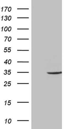 ABCB1 Monoclonal Antibody (OTI10C1), TrueMAB , OriGene:Antibodies:Primary