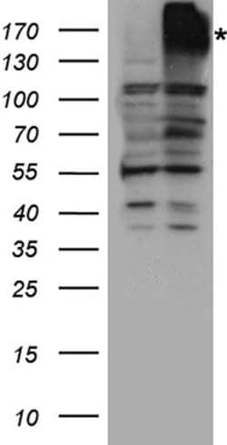 ABCB1 Rabbit anti-Human, Mouse, Rat, Polyclonal, liquid, OriGene 100 &mu;L;
