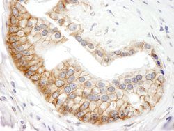 ABCB9 Polyclonal Antibody, Bethyl Laboratories:Antibodies:Primary Antibodies