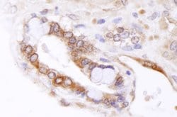 ABCB9 Polyclonal Antibody, Bethyl Laboratories 10 &mu;l; Unlabeled:Antibodies,