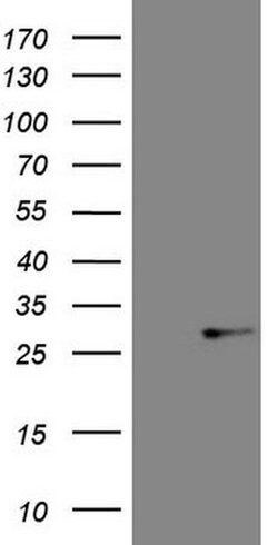 ABCC5 Monoclonal Antibody (OTI5F4), TrueMAB , OriGene:Antibodies:Primary