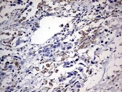 ABCD1 Monoclonal Antibody (OTI4E2), TrueMAB , OriGene 100 &mu;L; Unconjugated:Antibodies,