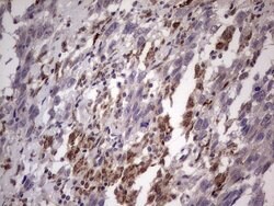 ABCD1 Monoclonal Antibody (OTI5G6), TrueMAB , OriGene 100 &mu;L; Unconjugated:Antibodies,