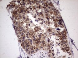 ABCD1 Mouse anti-Human, Clone: OTI5G6, lyophilized, TrueMAB 100 &mu;g;