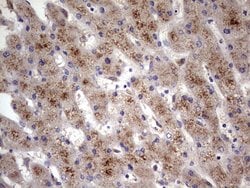 ABCD1 Monoclonal Antibody (OTI5G6), TrueMAB , OriGene 100 &mu;L; Unconjugated:Antibodies,