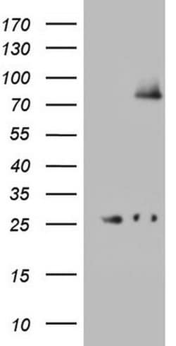 ABCD1 Monoclonal Antibody (OTI4E2), TrueMAB , OriGene 100 &mu;L; Unconjugated:Antibodies,