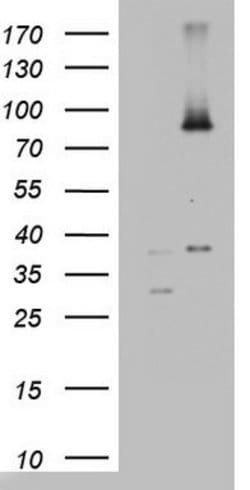 ABCD1 Mouse anti-Human, Clone: OTI2C12, lyophilized, TrueMAB 100 &mu;g;
