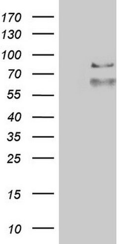 ABCD1 Monoclonal Antibody (OTI2E9), TrueMAB , OriGene 100 &mu;L; Unconjugated:Antibodies,