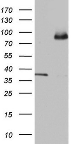 ABCD1 Mouse anti-Human, Clone: OTI5G6, lyophilized, TrueMAB 100 &mu;g;