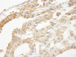 ABCF2 Polyclonal Antibody, Bethyl Laboratories:Antibodies:Primary Antibodies