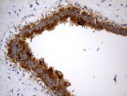 ABCF2 Monoclonal Antibody (OTI8F4), TrueMAB , OriGene 100 &mu;L; Unconjugated:Antibodies,