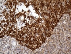ABCF2 Monoclonal Antibody (OTI8F4), TrueMAB , OriGene 100 &mu;L; Unconjugated:Antibodies,