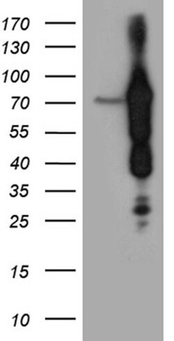 ABCF2 Mouse anti-Human, Mouse, Clone: OTI5D5, lyophilized, TrueMAB 100
