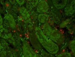 Invitrogen NGAL Monoclonal Antibody (29) 400 &mu;L; Unconjugated:Antibodies,