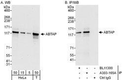 ABTAP Rabbit anti-Human, Polyclonal, Bethyl Laboratories 100 &mu;L; Unconjugated:Antibodies,