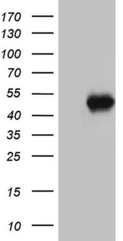 ABTB1 Mouse anti-Human, Clone: OTI3G8, lyophilized, TrueMAB 100 &mu;g;
