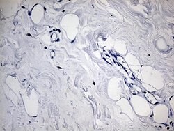 ACAA1 Monoclonal Antibody (OTI4F1), TrueMAB , OriGene 100 &mu;L; Unconjugated:Antibodies,