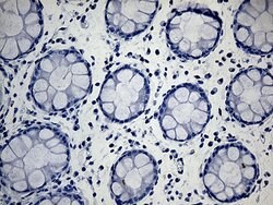 ACAA1 Monoclonal Antibody (OTI4F1), TrueMAB , OriGene 100 &mu;L; Unconjugated:Antibodies,