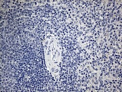 ACAA1 Monoclonal Antibody (OTI4F1), TrueMAB , OriGene 100 &mu;L; Unconjugated:Antibodies,