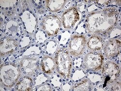 ACAA1 Monoclonal Antibody (OTI4F1), TrueMAB , OriGene 100 &mu;L; Unconjugated:Antibodies,