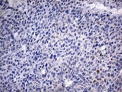ACAA1 Monoclonal Antibody (OTI4F1), TrueMAB , OriGene 100 &mu;L; Unconjugated:Antibodies,