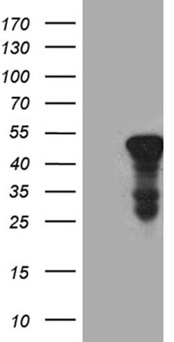 ACAA1 Monoclonal Antibody (OTI4F1), TrueMAB , OriGene 100 &mu;L; Unconjugated:Antibodies,