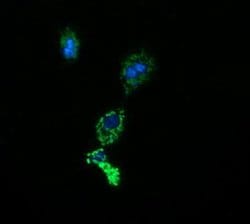ACAA2 Monoclonal Antibody (OTI1D3), TrueMAB , OriGene 100 &mu;L; Unconjugated:Antibodies,