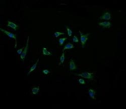 ACAA2 Monoclonal Antibody (OTI1D3), TrueMAB , OriGene 100 &mu;L; Unconjugated:Antibodies,