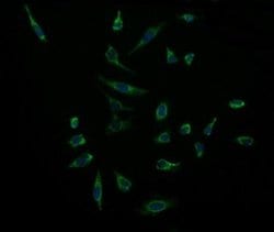 ACAA2 Monoclonal Antibody (OTI2H2), TrueMAB , OriGene 100 &mu;L; Unconjugated:Antibodies,