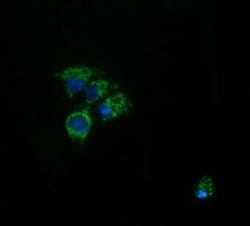 ACAA2 Mouse anti-Canine, Human, Mouse, Rat, Clone: OTI2G6, lyophilized,