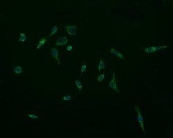 ACAA2 Mouse anti-Canine, Human, Mouse, Rat, Clone: OTI2G6, lyophilized,