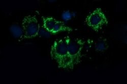ACAA2 Mouse anti-Human, Clone: OTI3H9, lyophilized, TrueMAB 100 &mu;g;