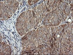 ACAA2 Monoclonal Antibody (OTI1D3), TrueMAB , OriGene 100 &mu;L; Unconjugated:Antibodies,