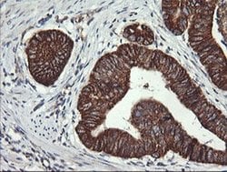 ACAA2 Monoclonal Antibody (OTI1D3), TrueMAB , OriGene:Antibodies:Primary