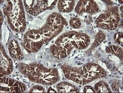 ACAA2 Monoclonal Antibody (OTI1D3), TrueMAB , OriGene 100 &mu;L; Unconjugated:Antibodies,